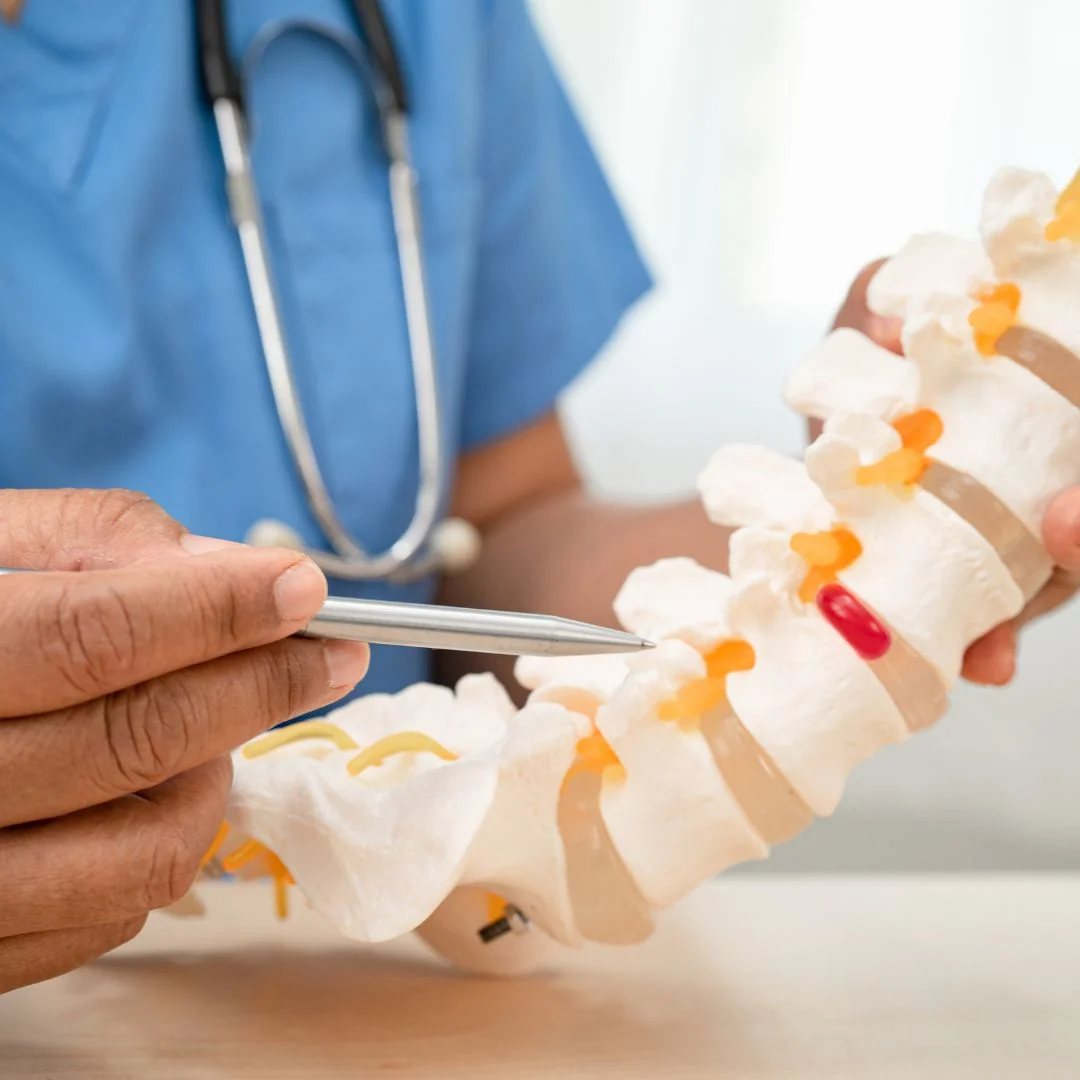 Kinesiología para hernia lumbar
